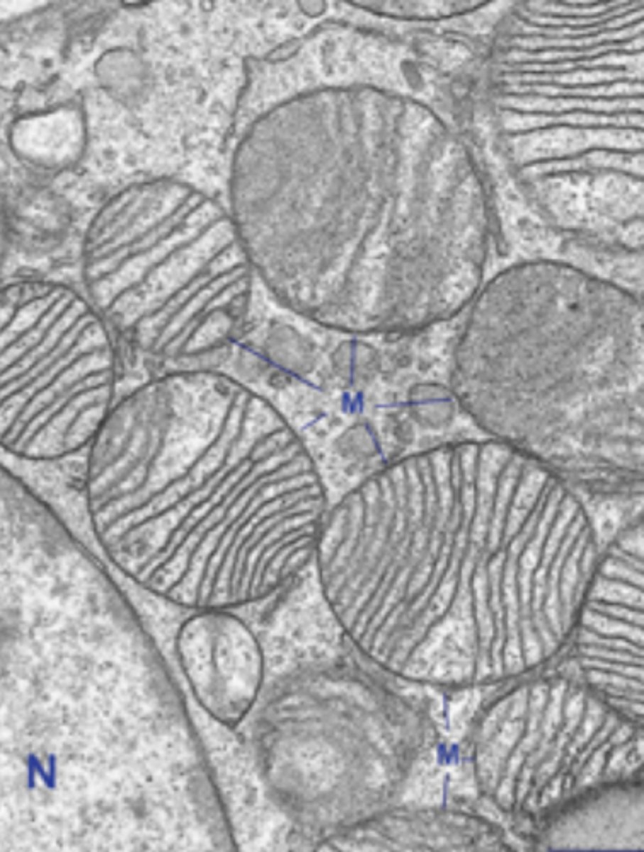 <p>what function is this type of mitochondria specialized for?</p>