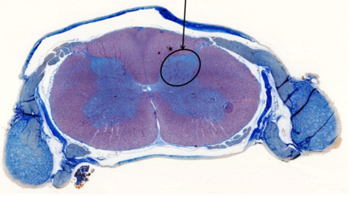 <p>Identify the part of the spinal cord</p>