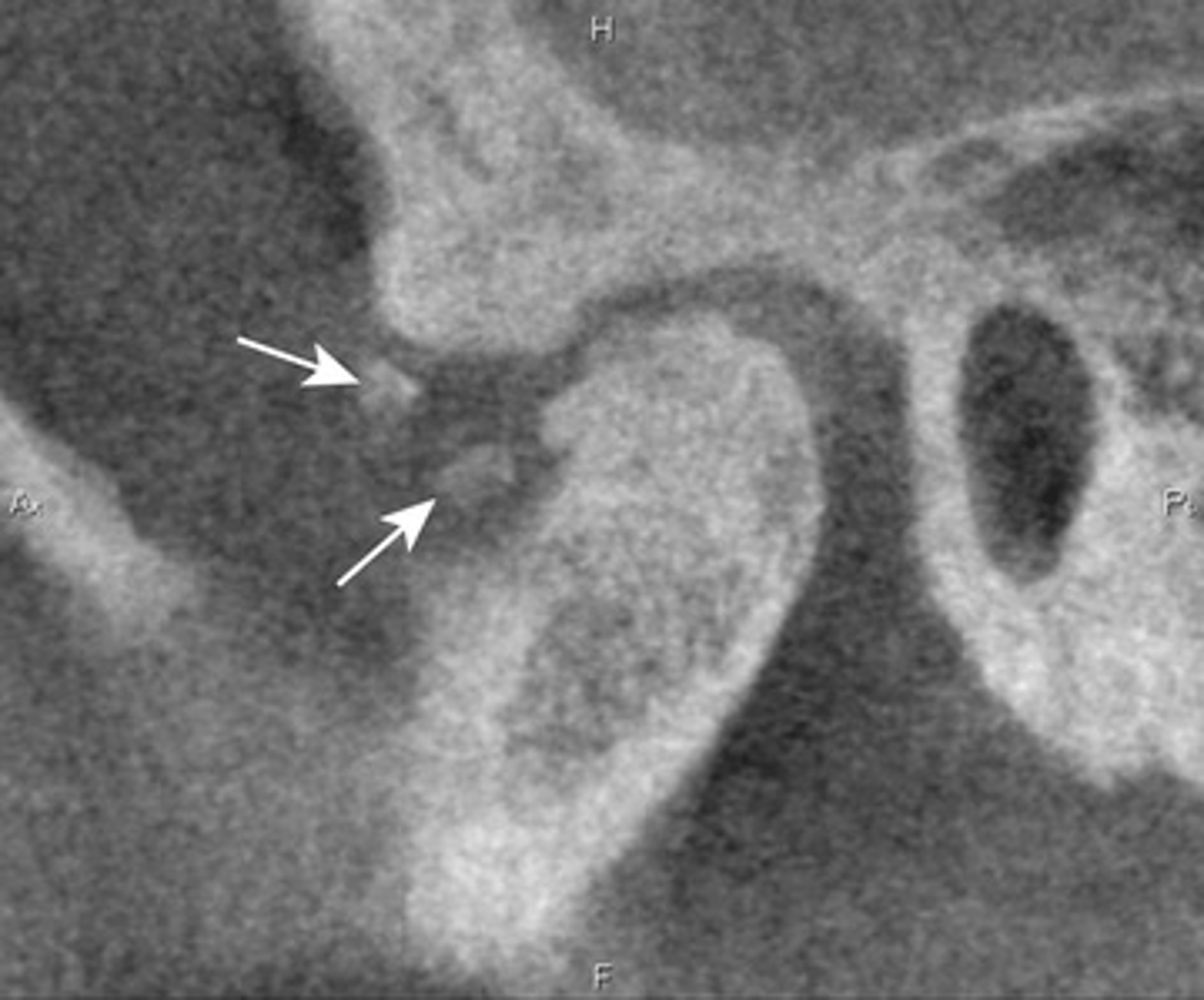 <p>What are the arrows showing?</p>