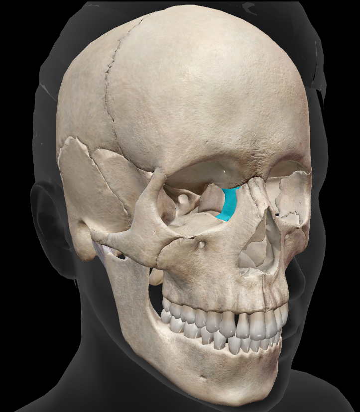 term image