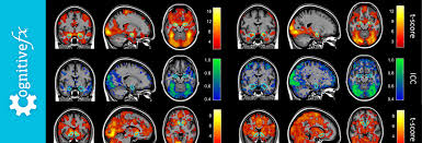 <p>fMRI (Functional MRI)</p>