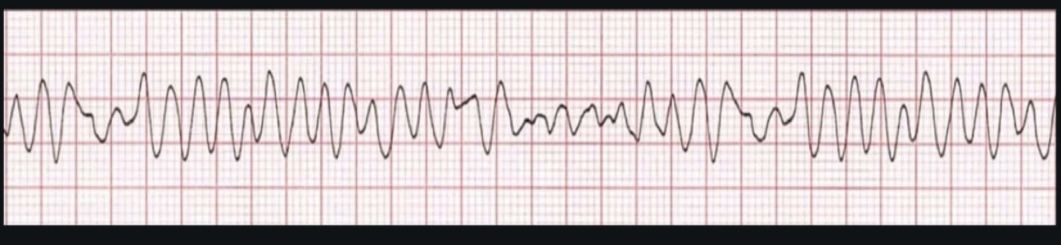 <p>ECG interpretation</p>
