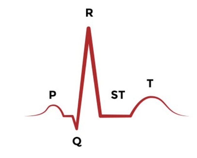 <p>P wave </p>