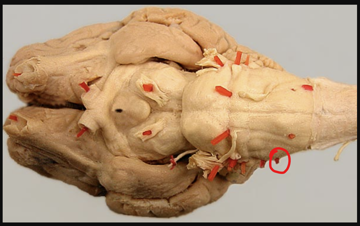 <p>Name the part of the brain in the red circle.</p>