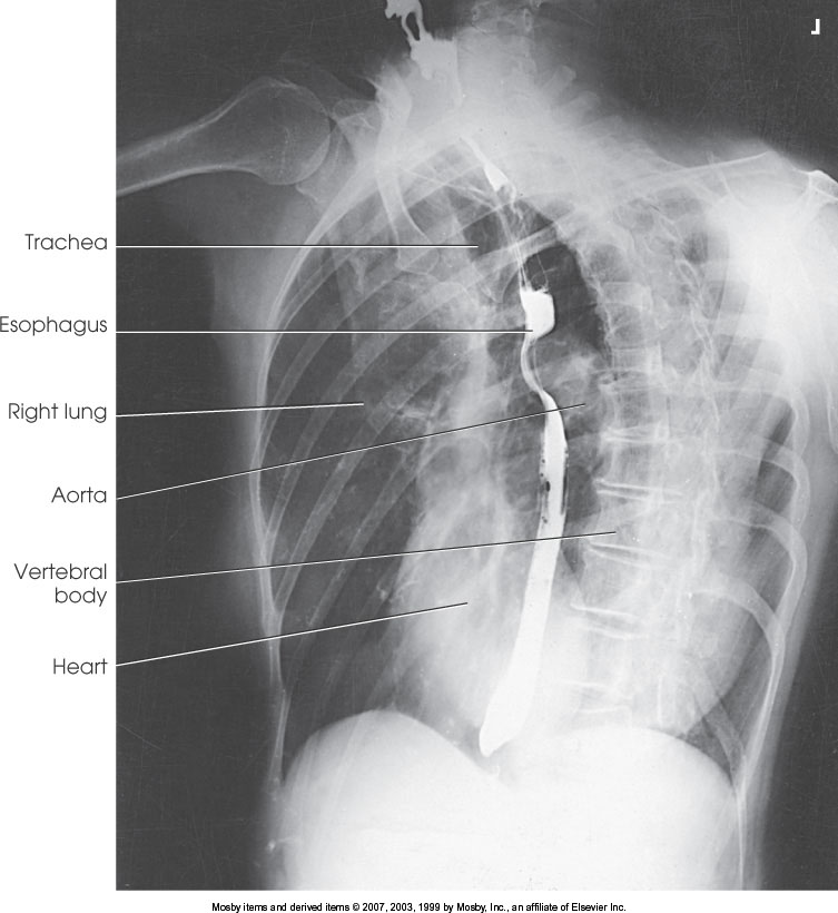 <p>What position is demonstrated?</p>