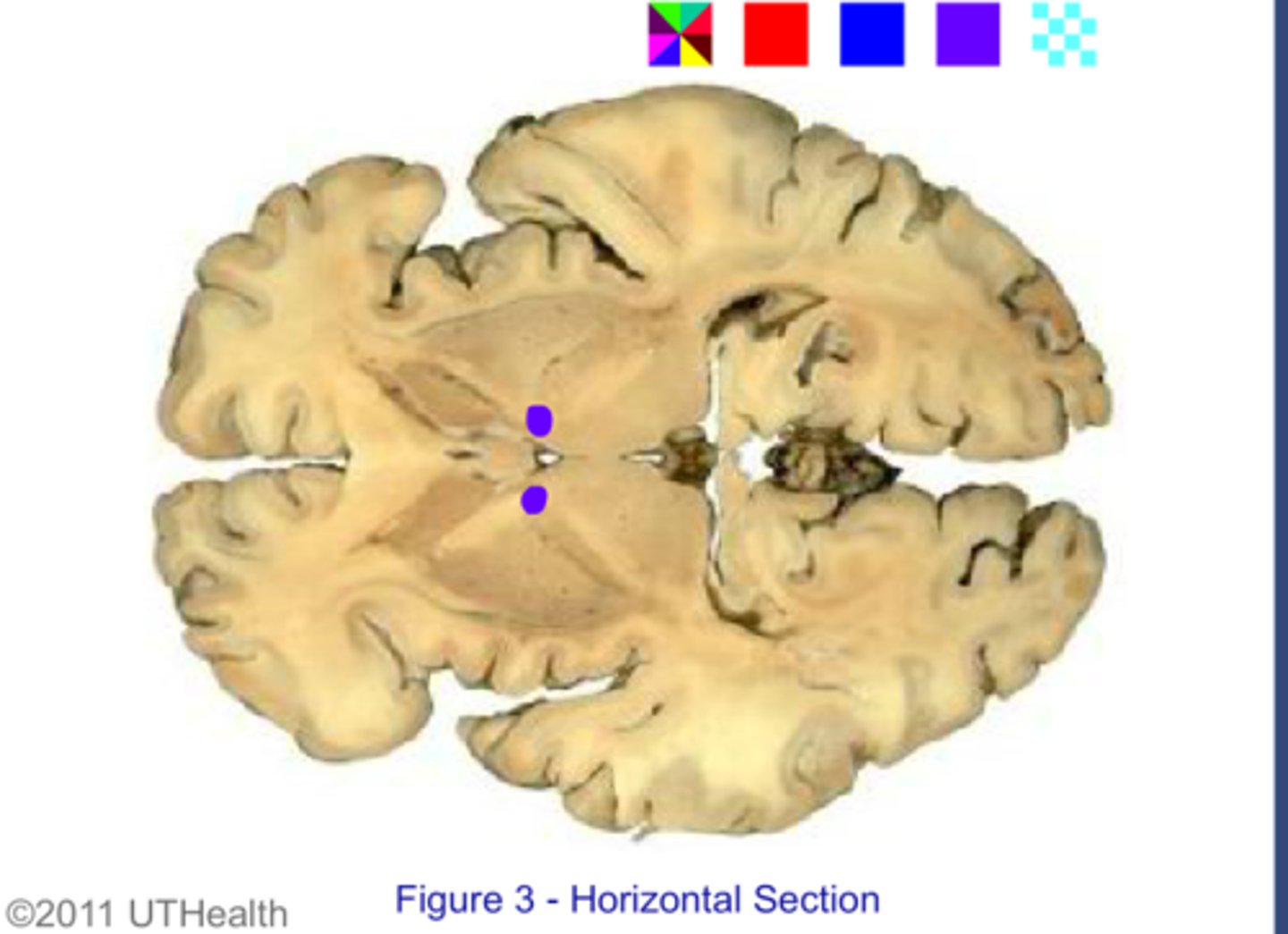 <p>Contains the <strong>corticobulbar tract</strong> (which predominately terminates at the cranial motor nuclei)</p>