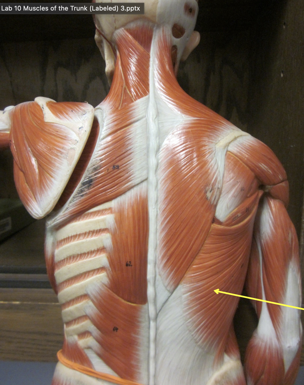 <p>Which muscle</p>