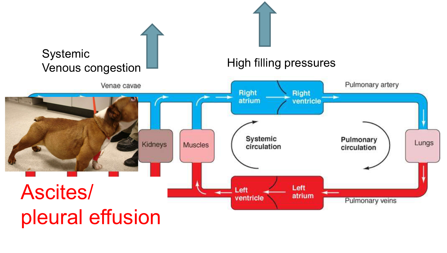 <ul><li><p>jugular distention</p></li><li><p>pleural effusion</p></li><li><p>hepatomegaly</p></li><li><p>ascites</p></li></ul><p></p>