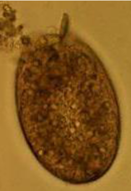 <ul><li><p><span>Hard to distinguish between Fasciola hepatica eggs</span></p></li><li><p><span>150 x 80 um</span></p></li><li><p><span>Ovoid, yellow-brown staining</span></p></li><li><p><span>Thin, smooth shell</span></p></li><li><p><span>Usually, an <u>indistinct operculum</u></span></p></li><li><p><span><u>Unembryonated</u>, material extends to shell margin</span></p></li></ul><p></p>