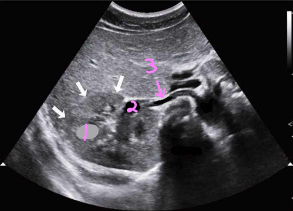 <p>Label this trans kidney image</p>