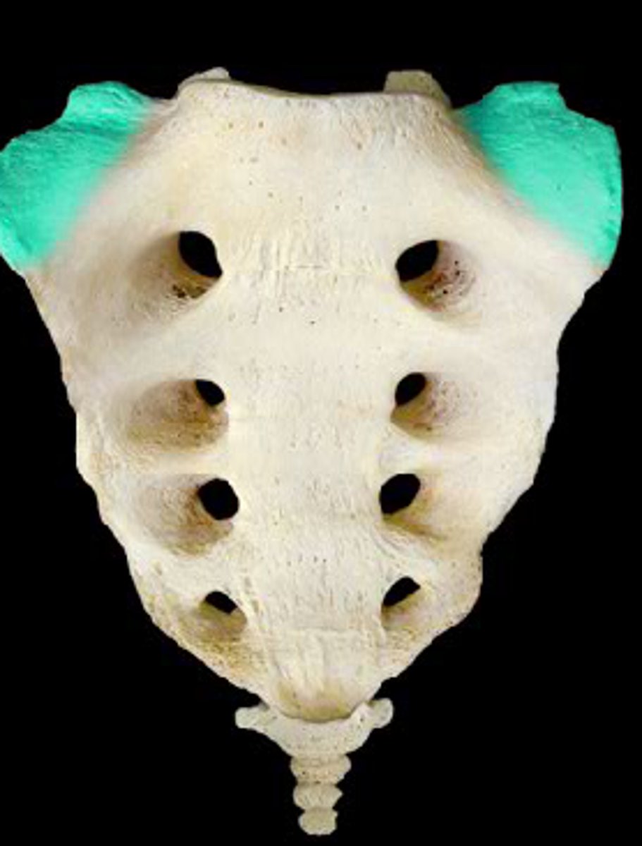 <p>Name the structure.</p>