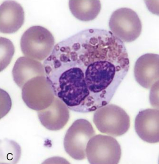 <p>Identify cell and abnormality</p>