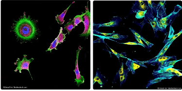<ul><li><p><span><strong>Best for:</strong> </span></p><ul><li><p><span>Visualizing specific proteins, organelles, or molecules in living or fixed cells using fluorescent labels.</span></p></li></ul></li><li><p><span><strong>Ex.</strong> Tracking the movement of a specific protein within a live cell.</span></p></li><li><p><span><strong>Why?</strong> </span></p><ul><li><p><span>Fluorescence microscopy allows for specific labeling using fluorophores and enables live-cell imaging.</span></p></li></ul></li></ul><p></p>