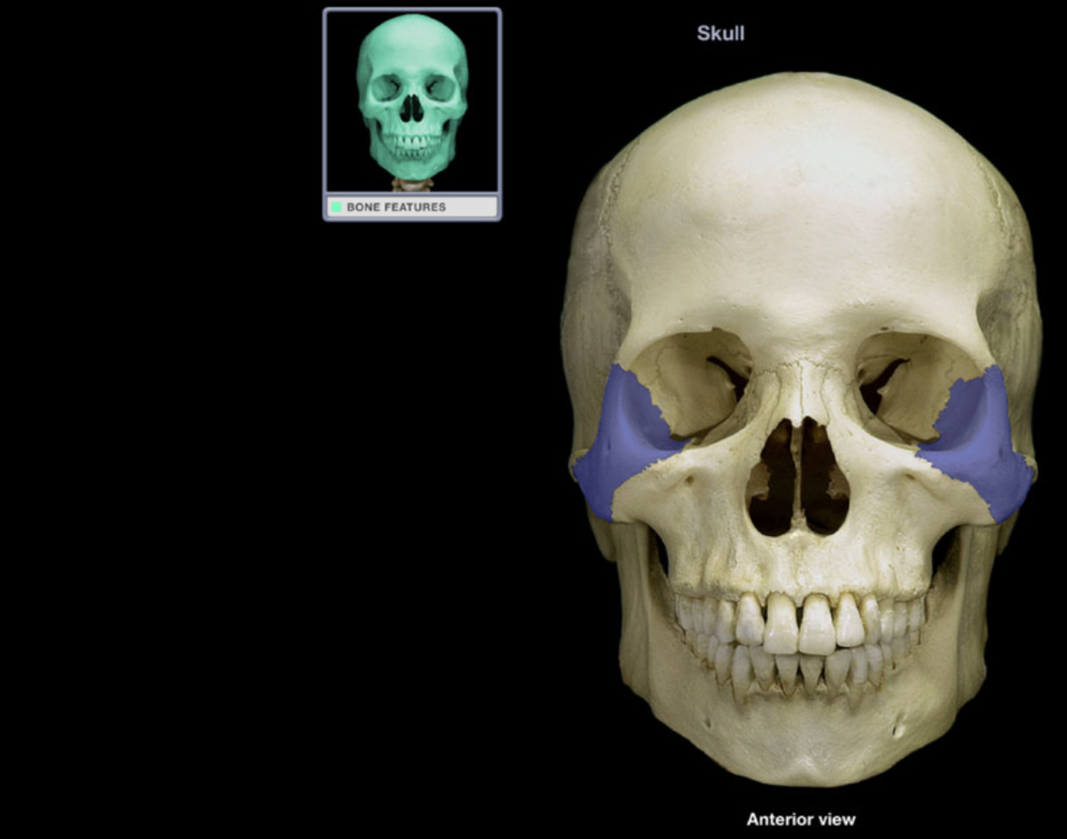 <p>Zygomatic bone</p>