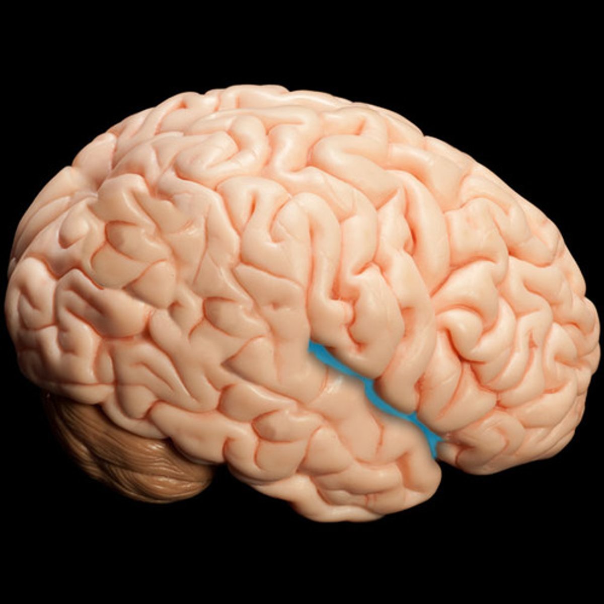 <p>separates temporal lobe from frontal and parietal lobes</p>