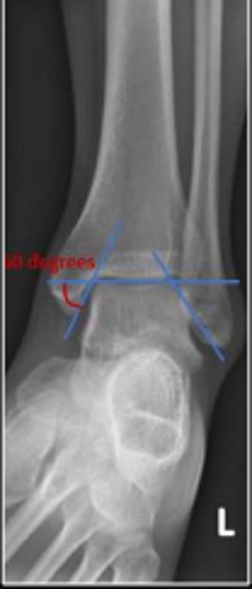 <p>Is the assessment within normal limits?</p>