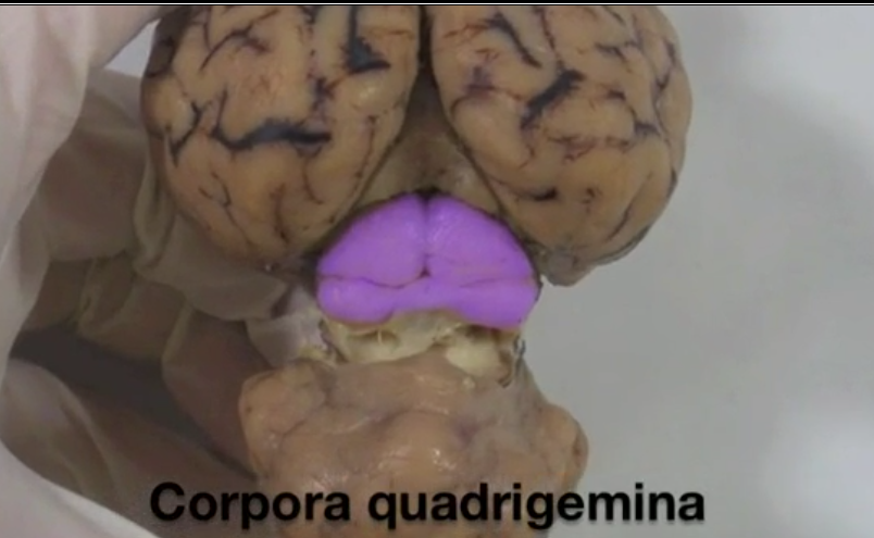 <p>Corpora quadrigemina</p>