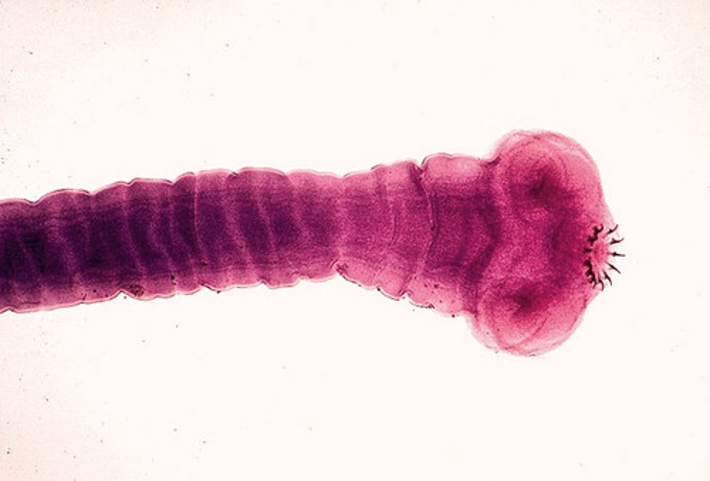 <p>-> Tapeworms</p><p>Endoparasites : Digestive + Muscular</p><p>- No Digestive system</p>