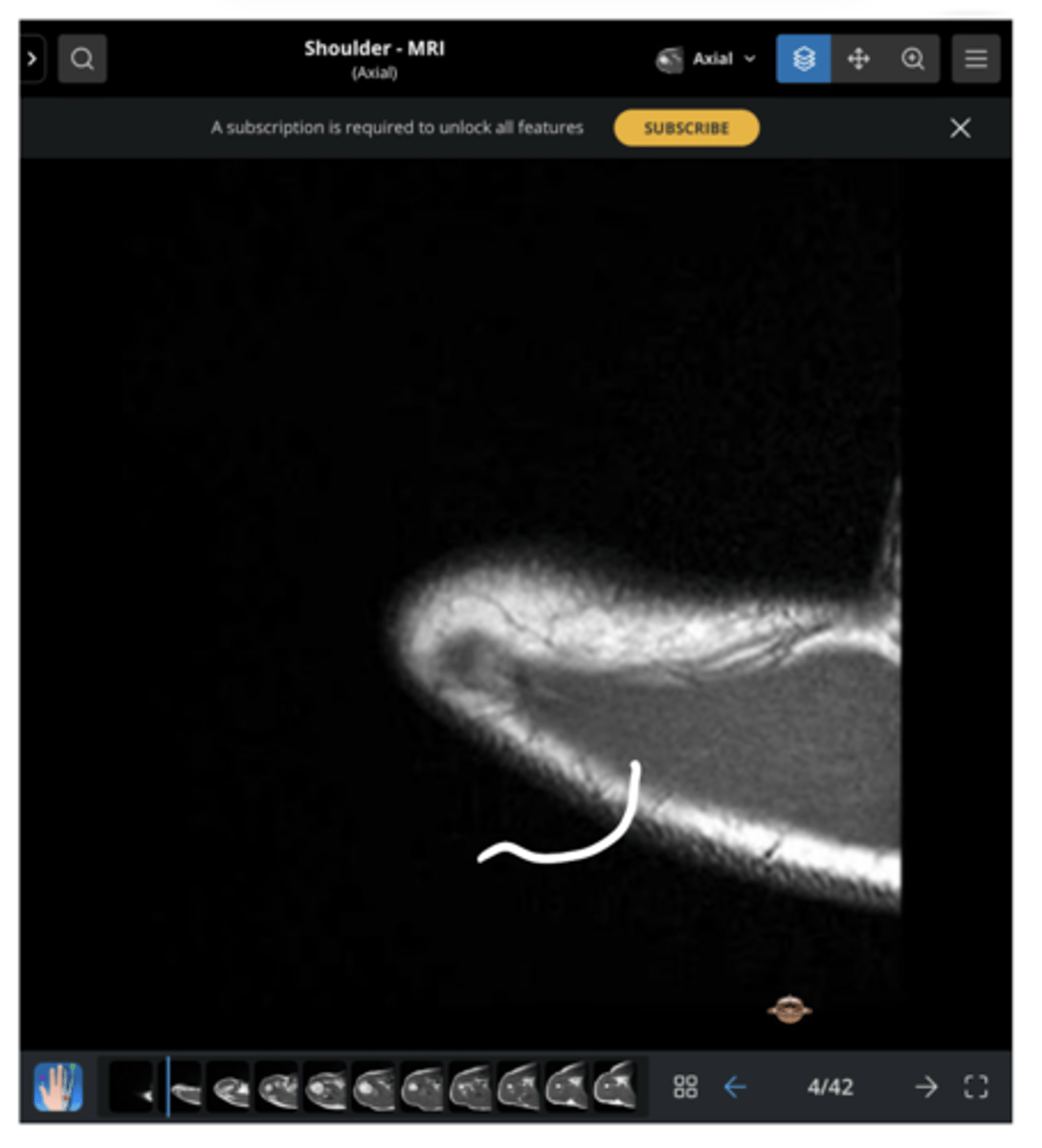 <p>Which structure is being pointed to in this image?</p>