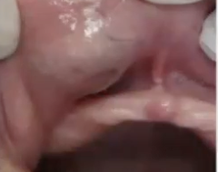 <p>What is the diagnosis?</p>