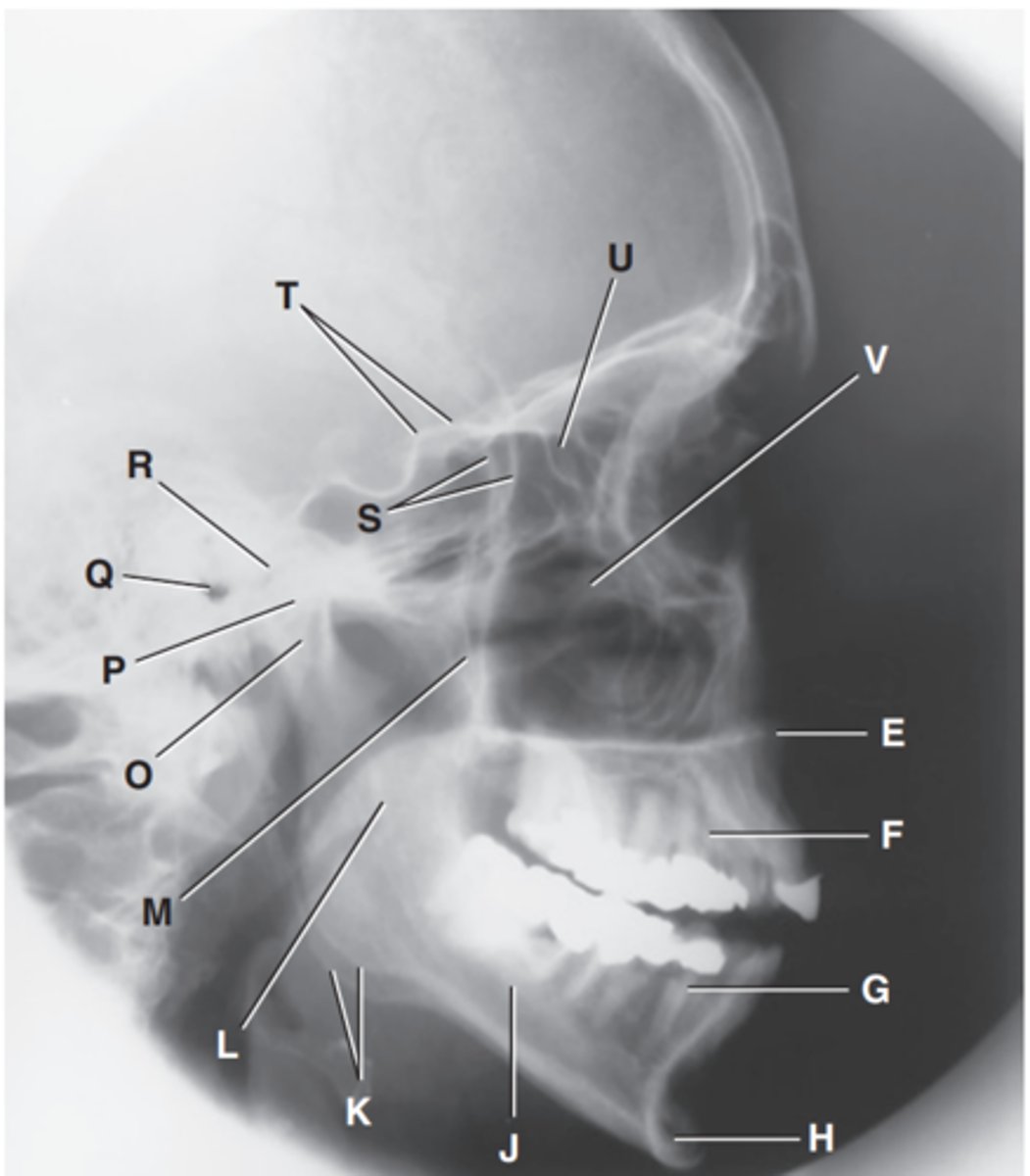 <p>Label M</p>