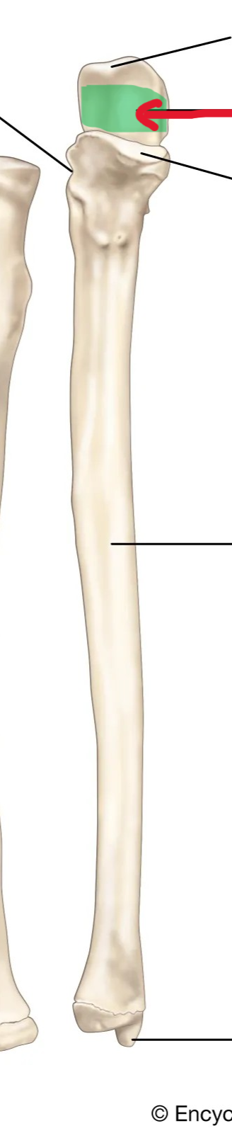 <p>What part of the ulna is this?</p>