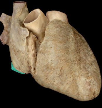 <p>Inferior vena cava</p>