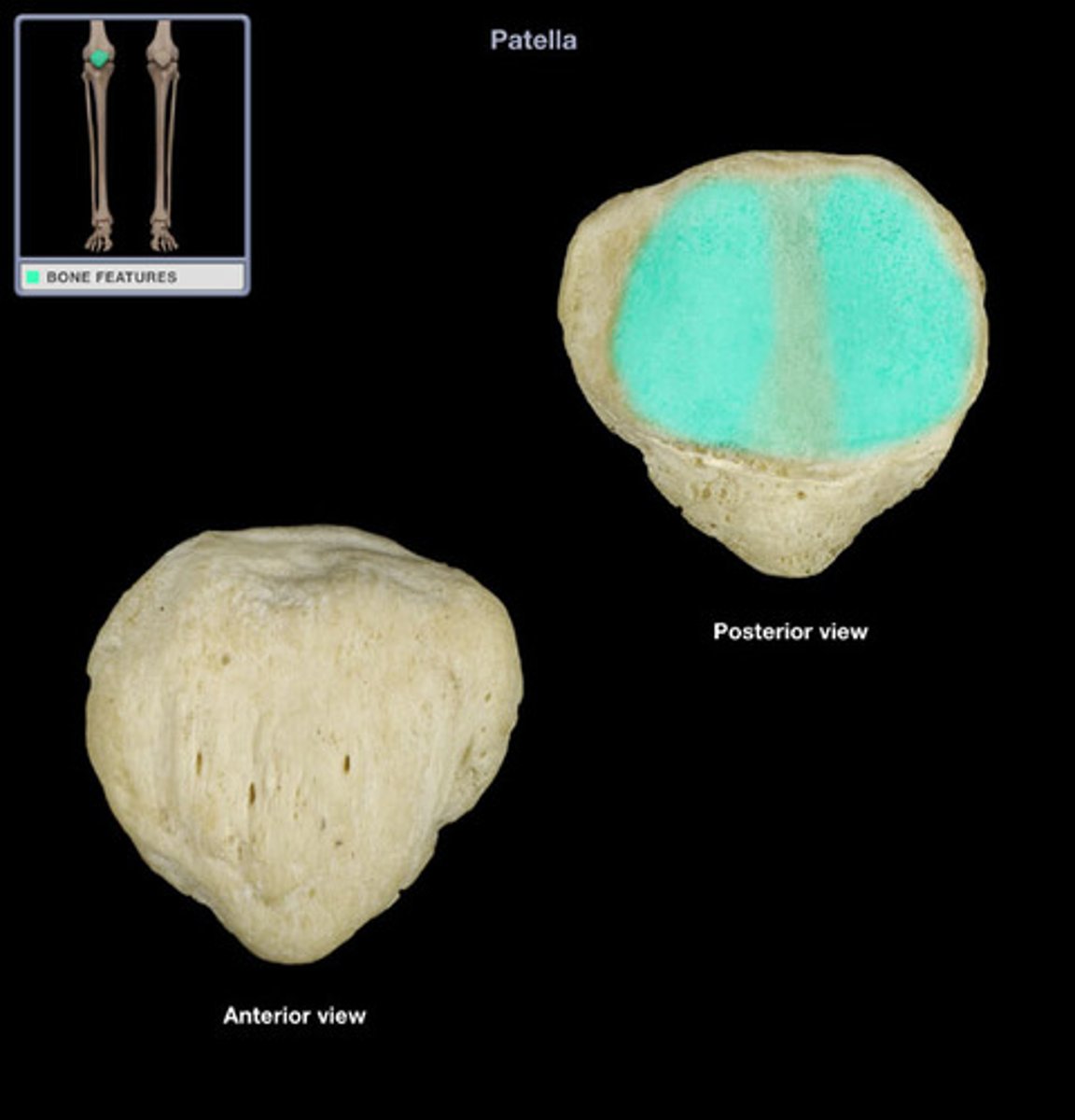<p>•Lateral facet</p><p>•Medial facet [smaller than the lateral facet]</p>