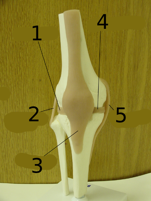 <p>#1</p>