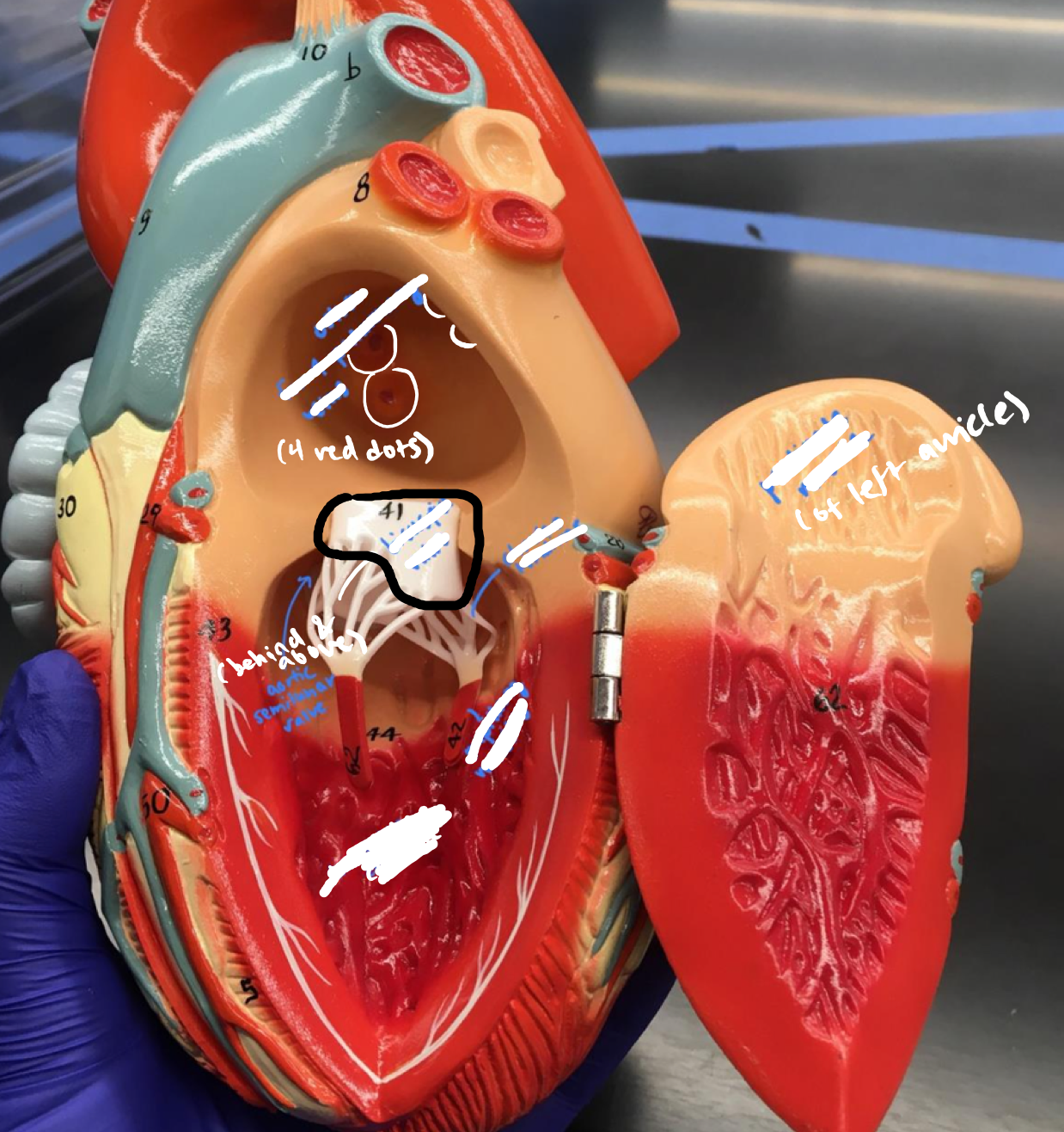 <p>The valve with 2 papillary muscle connections</p>