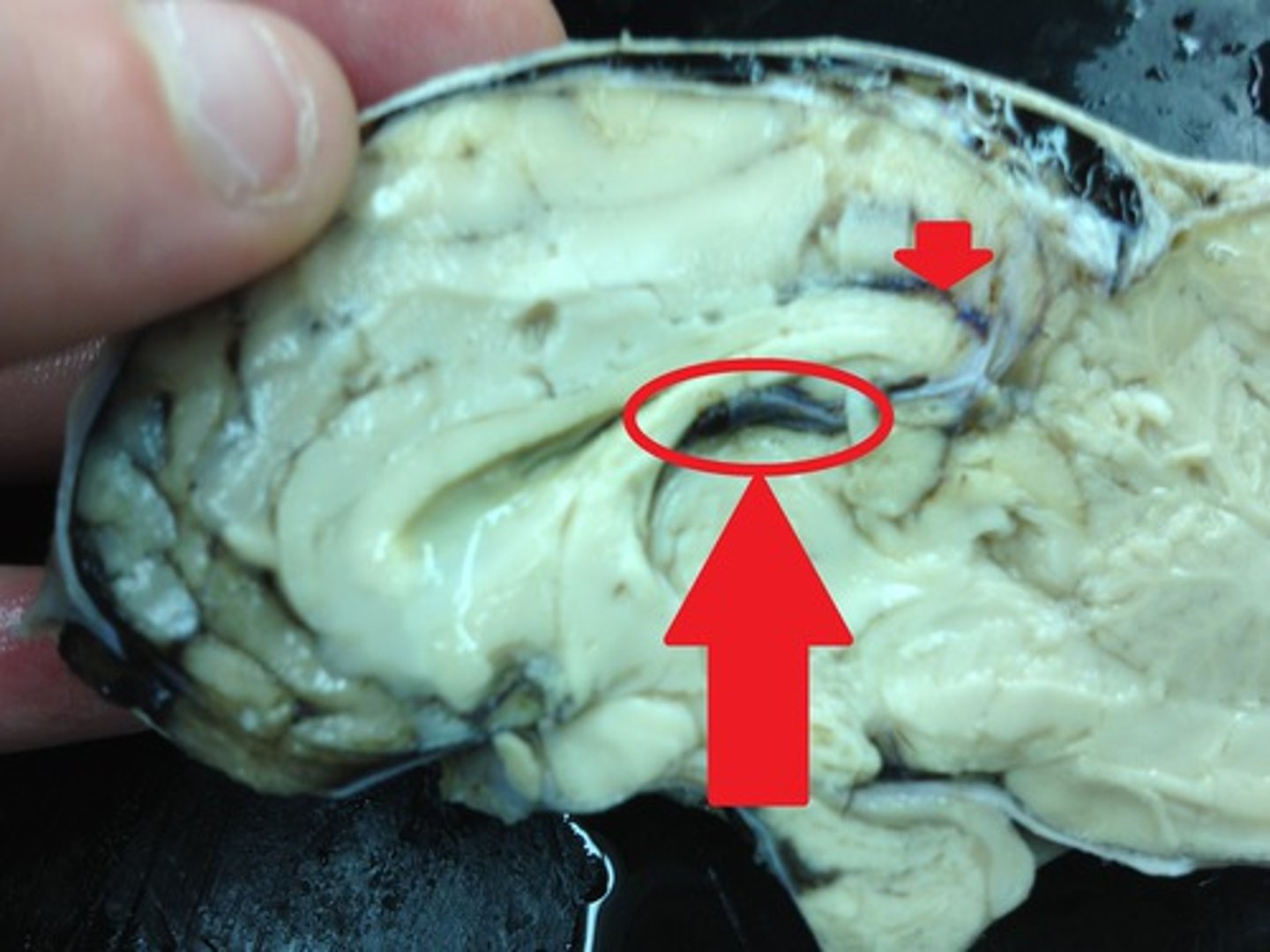 <p>pocket under the fornix</p>