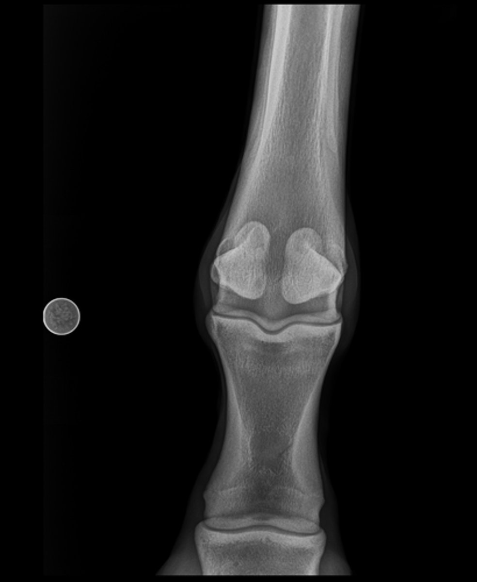 <p>Name the view and the anatomical region within the radiograph</p>
