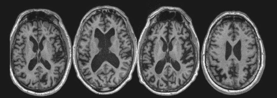 this is the development of an individual's brain. Explain whether this is healthy or unhealthy and why.