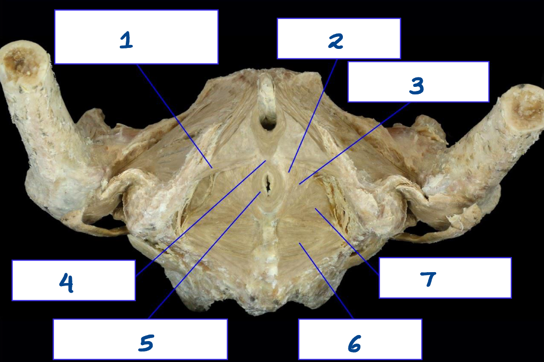 <p>What is structure 4?</p>