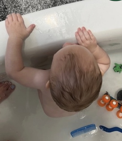 <p>analyze this pic:</p><ul><li><p>head position</p></li><li><p>torticollis</p></li><li><p>plagiocephaly</p></li><li><p>other possible related condition</p></li><li><p>treatment/stretching</p></li></ul><p></p>