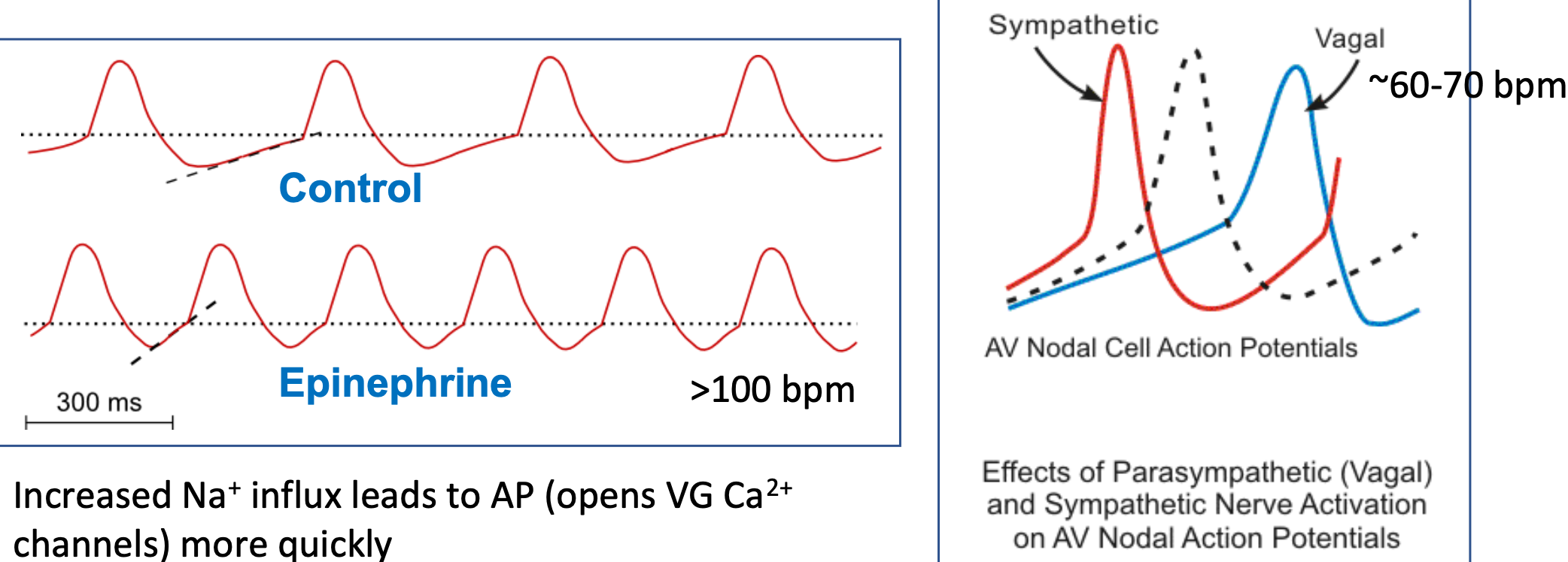<ol><li><p>Release of epinephrine/norepinephrine</p></li><li><p>Epinephrine/norepinephrine binds to B1 receptors</p></li><li><p>Opens HCN “pacemaker” channels</p><ol><li><p>Called HCN channels – hyperpolarization-activated cyclic nucleotide-gated Na+ channels</p></li></ol></li><li><p><strong>Influx of Na+</strong> (Sodium in)</p></li><li><p><strong>Speeds up heart rate</strong> (due to increased Na+ influx)</p></li><li><p>Quicker AP (increased slope of pacemaker potential)</p></li></ol>