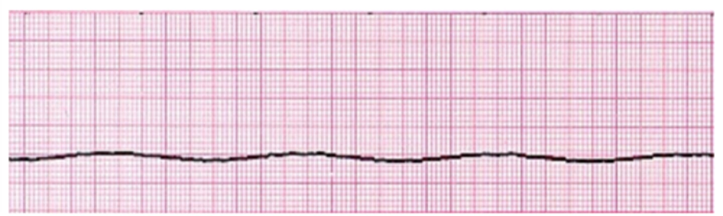 <p>What is this?</p>