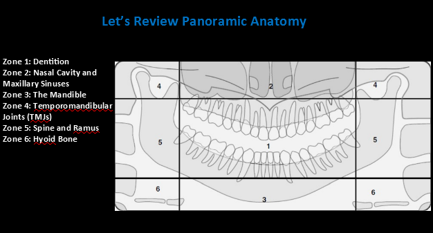<p>Zone 1: Dentition </p><p>Zone 2: Nasal Cavity and Maxillary Sinuses</p><p>Zone 3: The Mandible </p><p>Zone 4: Temporomandibular Joints (TMJs) </p><p>Zone 5: Spine and Ramus </p><p>Zone 6: Hyoid Bone</p>