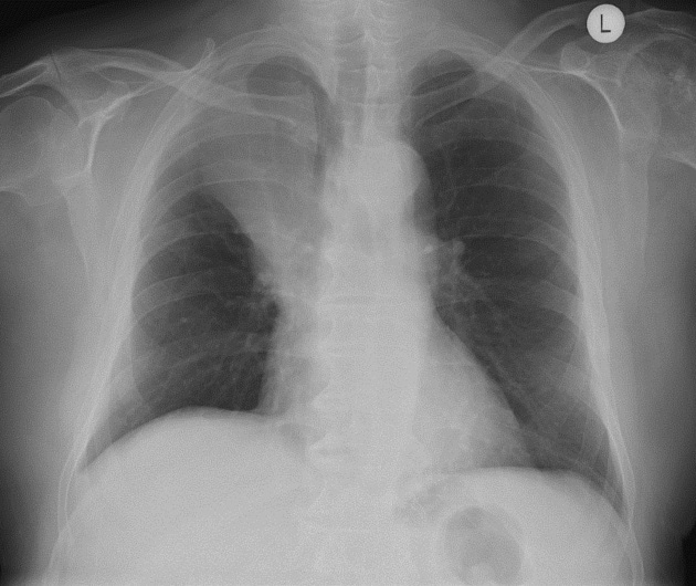 <p>Describe the abnormality demonstrated.</p>
