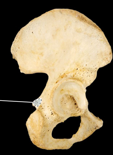 <p>Hip bone, lateral view, right ischium</p>