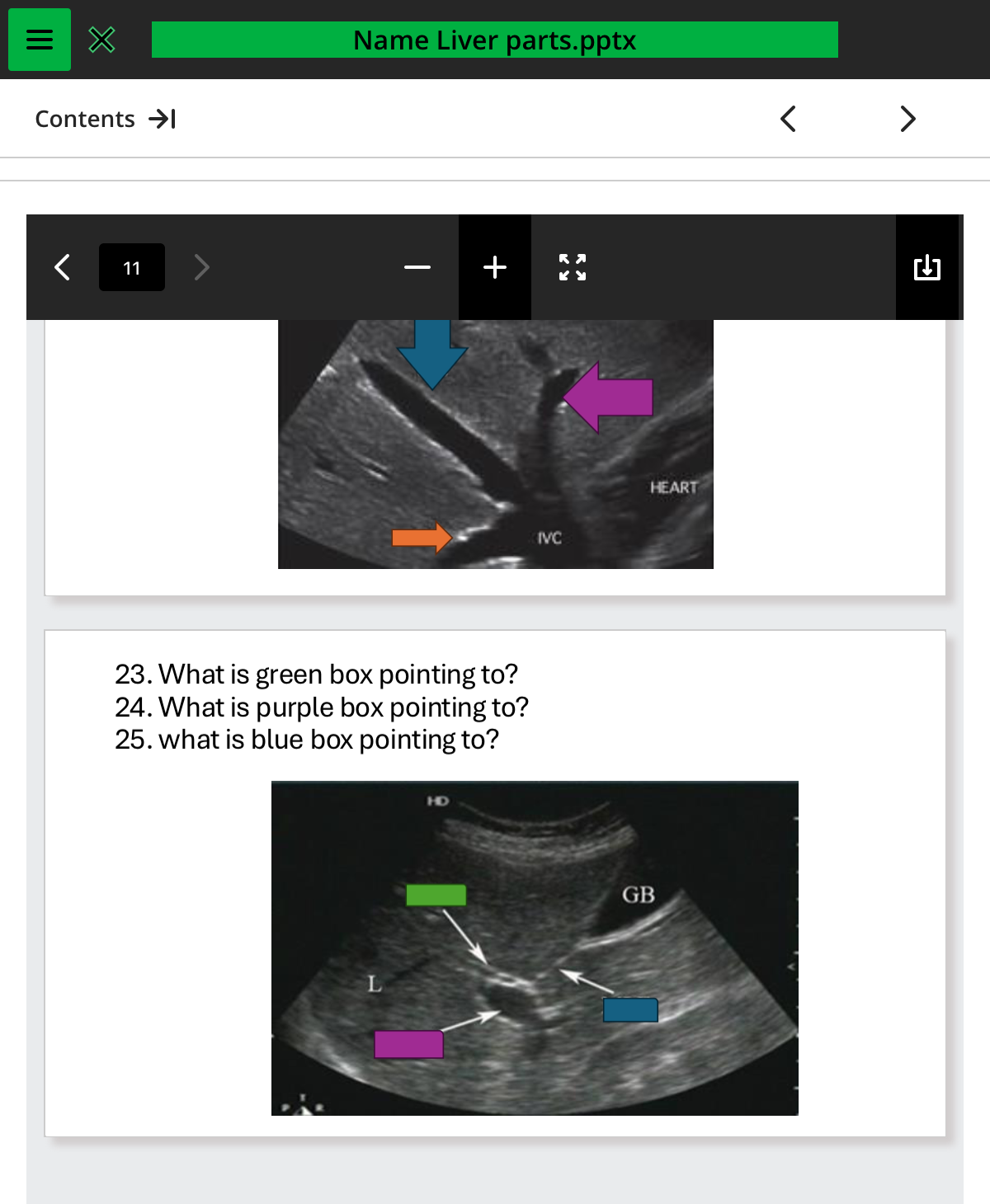 <ol start="24"><li><p>what is purple box pointing to </p></li></ol>