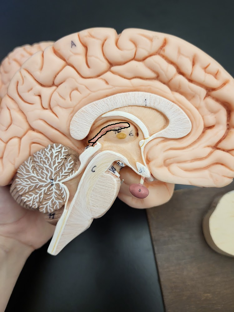 <p>brain region that contains choroid plexus &amp; the pineal gland</p>