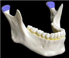 <p>Articulation point of the mandible with the mandibular fossa of the temporal bone</p>