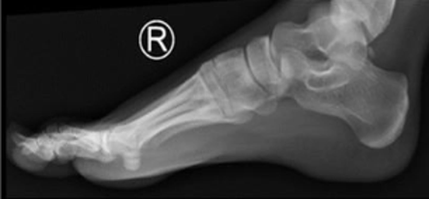 <p>What is the name of the radiographic view?</p>