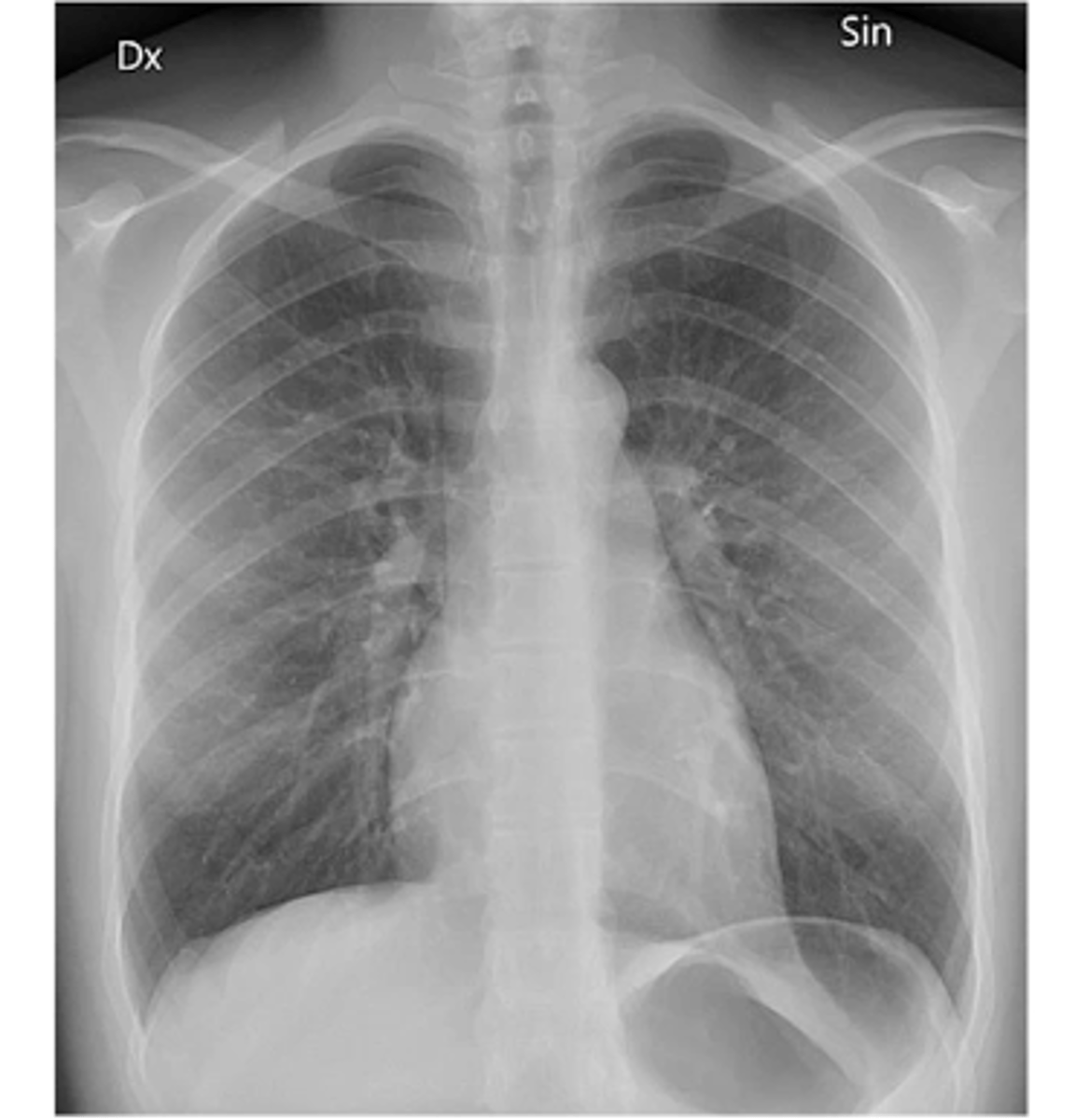 <p>State the type of view and structure being depicted.</p>