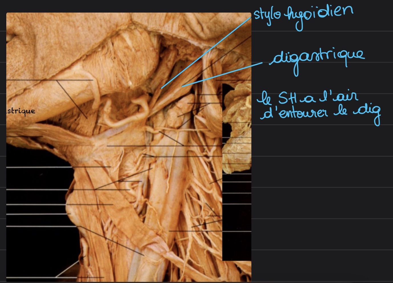 <p>composé de 2 faisceaux, le muscle digastrique (ventre postérieur) passe en travers d’eux</p>