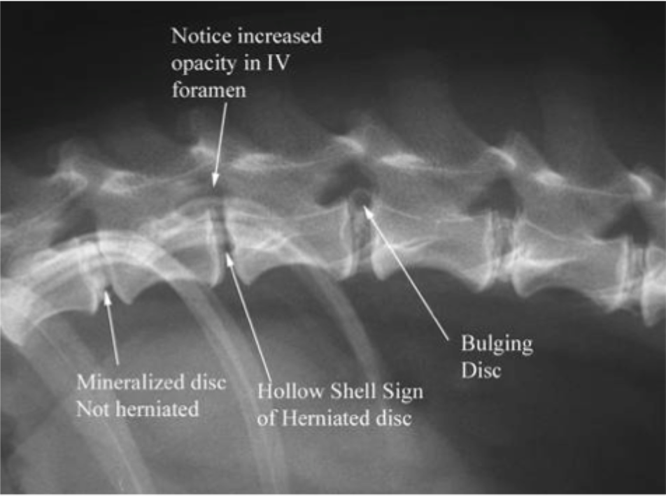 <p><strong>IVDD</strong></p><ul><li><p><strong>Intervertebral disc disease&nbsp;</strong></p></li><li><p>Annulus fibrosis ruptures</p><ul><li><p>disc gets pushed into the spinal cord (neurologic symptoms)</p></li></ul></li></ul><p></p>