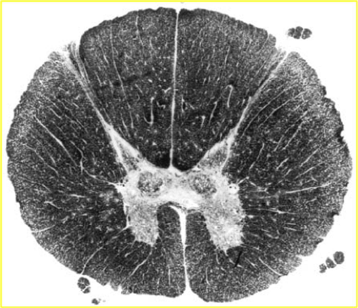 <p>very small amount of grey matter</p>