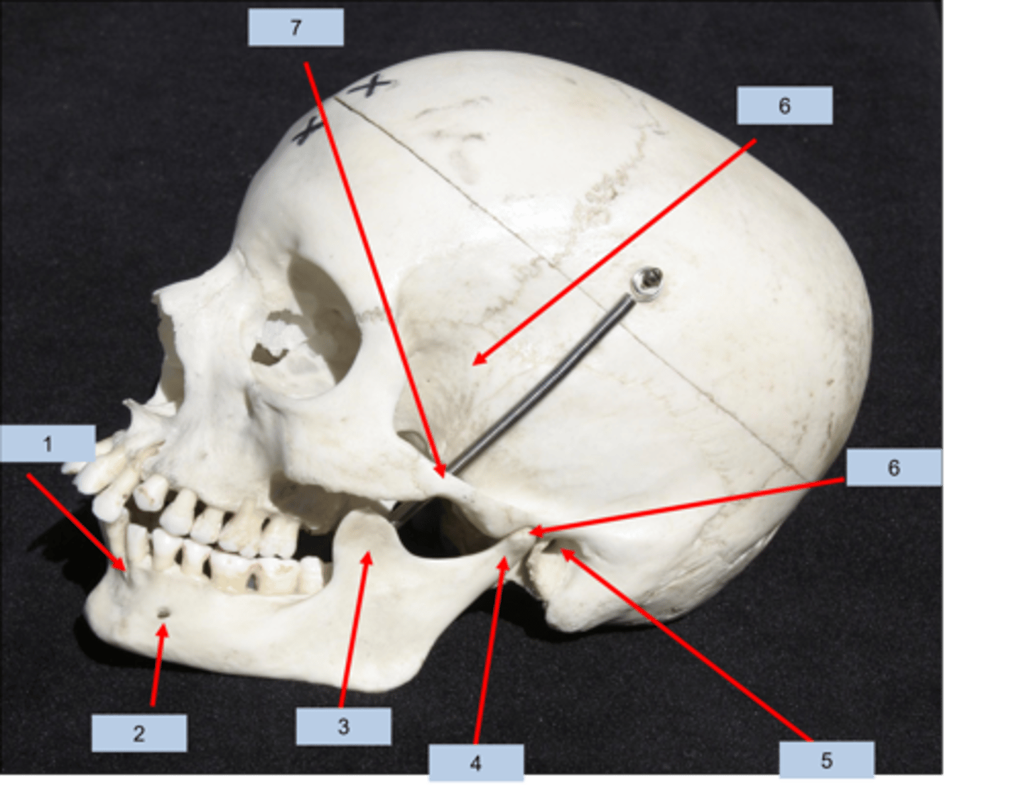 <p>What is #1 pointing to?</p>