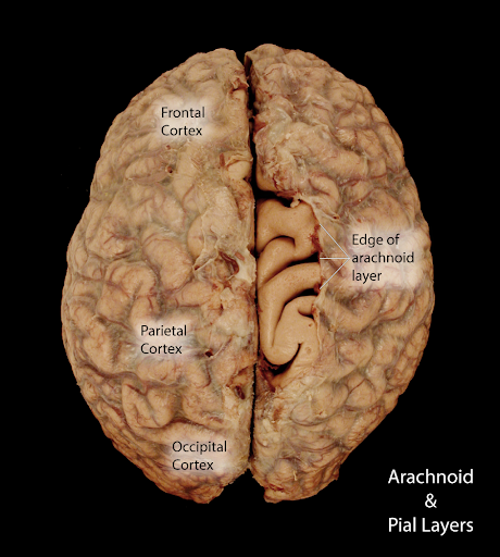 <p>middle layer of your meninges, thin, looks like spiderweb. usually has CSF under it.</p>